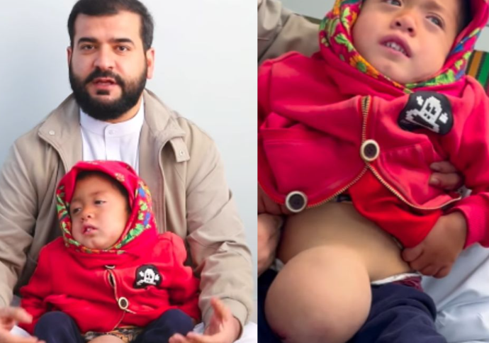 👶 CAIO NASCEU POR MILAGRE — MAS PRECISA DE AJUDA PARA CONTI