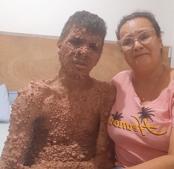 ATENÇÃO: O FELIPE PRECISA DE AJUDA PARA CONTINUAR LUTANDO